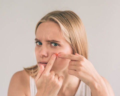 Eliminer les cicatrices d'acnée