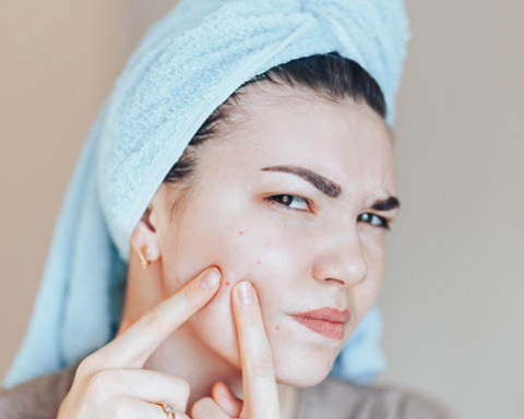 Comment réduire une forte acnée ?