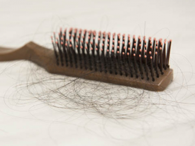 Comment lutter contre la perte de cheveux ? | Biocyte