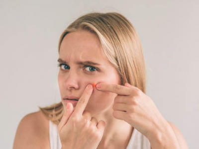 Eliminer les cicatrices d'acnée