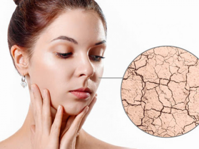 Bien hydrater sa peau de l'intérieur