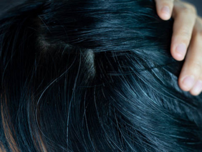 Réduire les cheveux blanc