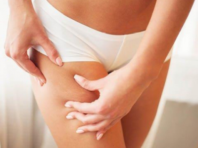 Dites non à la cellulite !